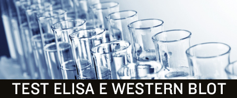 Hiv test positivo? Leggi come funziona l'Elisa e il Western Blot.